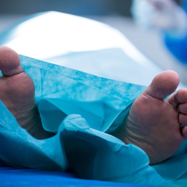 Close-up of patient lying on bed Close-up of patient lying on bed at the hospital
