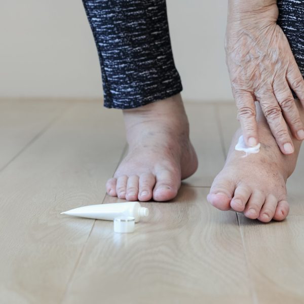 Elderly woman putting cream on swollen feet Elderly woman putting cream on swollen feet