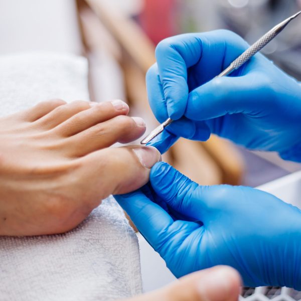 quiropodia quiropodia